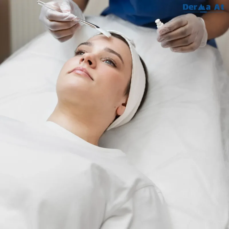 Lactic Peel