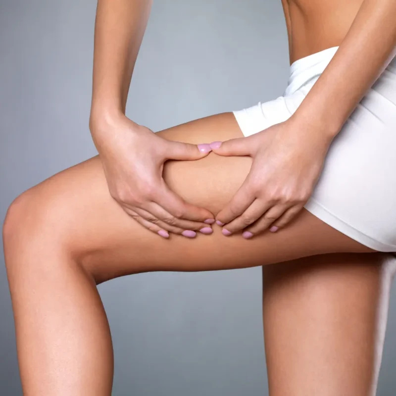 Thighs Inch Loss